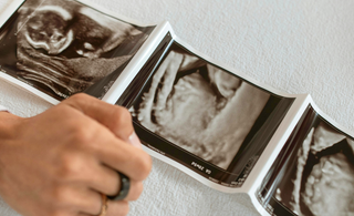 Understanding morning sickness: when it starts, what to expect, and how to deal with it